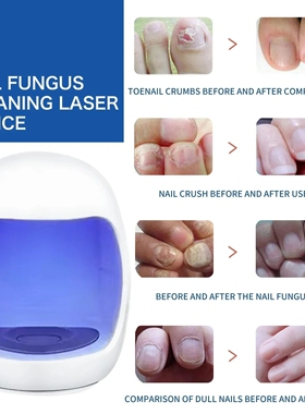 Fungal Nail Laser Device Repair Fast Onychomycosis指甲护理仪