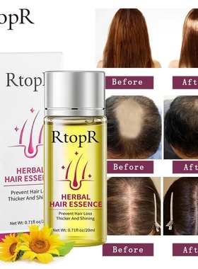 Herbal Hair Growth Anti Loss Liquid Promote Thick Fast护发
