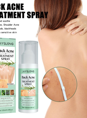 Body Back Chest Acne Treatment Serum Spray Redness Calm喷雾
