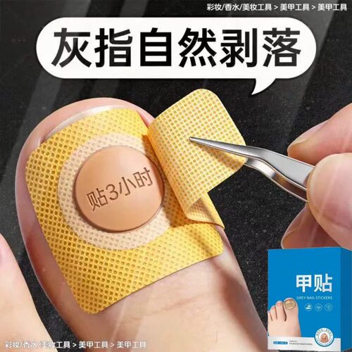 【官方正品】指甲贴正品专用灰趾贴植物萃取脚趾手指甲修护专用贴