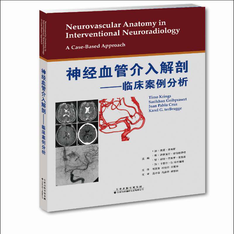 神经血管介入解剖:临床案例分析:a caased approac 提莫·克林斯 神经外科手术血管外科手术介入性 医药卫生书籍天津科技翻译出版