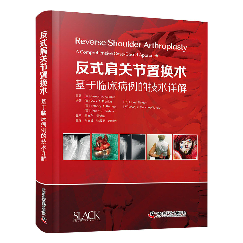 反式肩关节置换术 基于临床病例的技术详解
