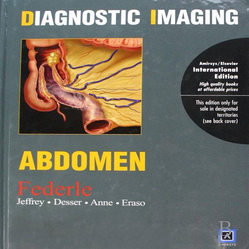 Diagnostic imaging:Abdomen  影象诊断英文研究人员医药卫生书籍上海世界图书出版公司