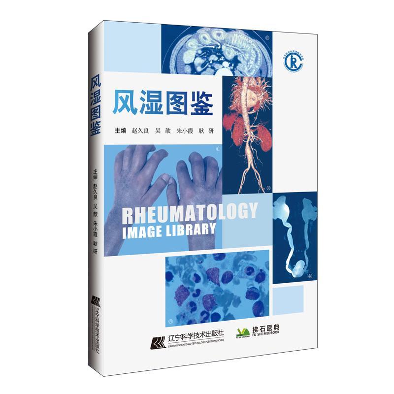 正版包邮风湿图鉴风湿免疫病学临床图鉴图谱图谱病理学影像学检查诊断书籍风湿免疫科风湿病关节炎类风湿疾病系统性红斑狼疮赵久良