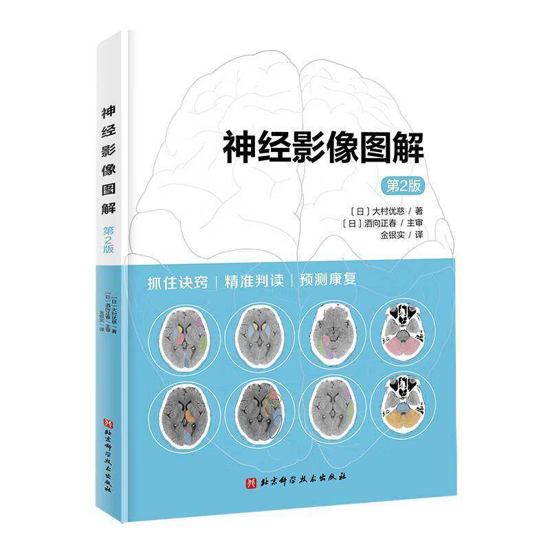 神经影像图解 第2版 大村优慈 脑部影像判断功能预后MRI CT 脑梗死出血影像知识阅片诀窍放射科神经内科康复科医师参考医学书籍