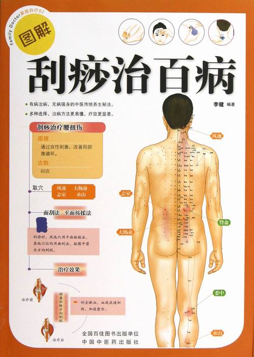 正版包邮 图解刮痧治百病 李健 书店 经络穴位书籍