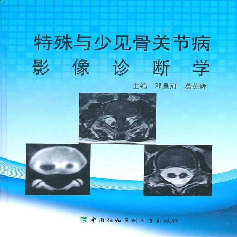 特殊与少见骨关节病影像诊断学 邓星河 医药卫生书籍正版中国协和医科大学出版社