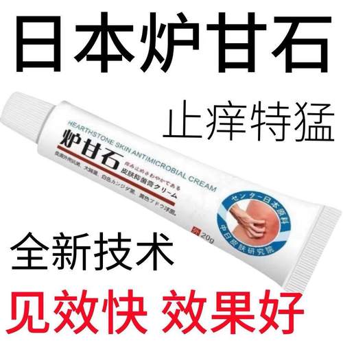 【日本进口】炉甘石皮肤瘙痒外用全身皮肤手脚干痒真菌止痒膏杀菌