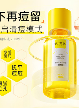 粉丝推荐】第二代闭口水无酸细毛孔湿敷祛闭口粉刺爽肤水舒缓控油