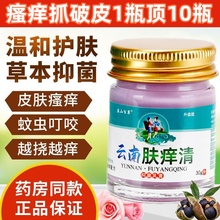 正品云南肤痒清过敏性皮炎湿疹荨麻疹皮肤瘙痒特效药膏蚊虫止痒膏