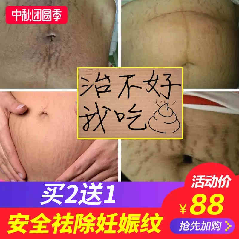 孕妇专用产前紧致肚皮去除妊娠纹预防修复霜祛妊辰纹消除产后大腿