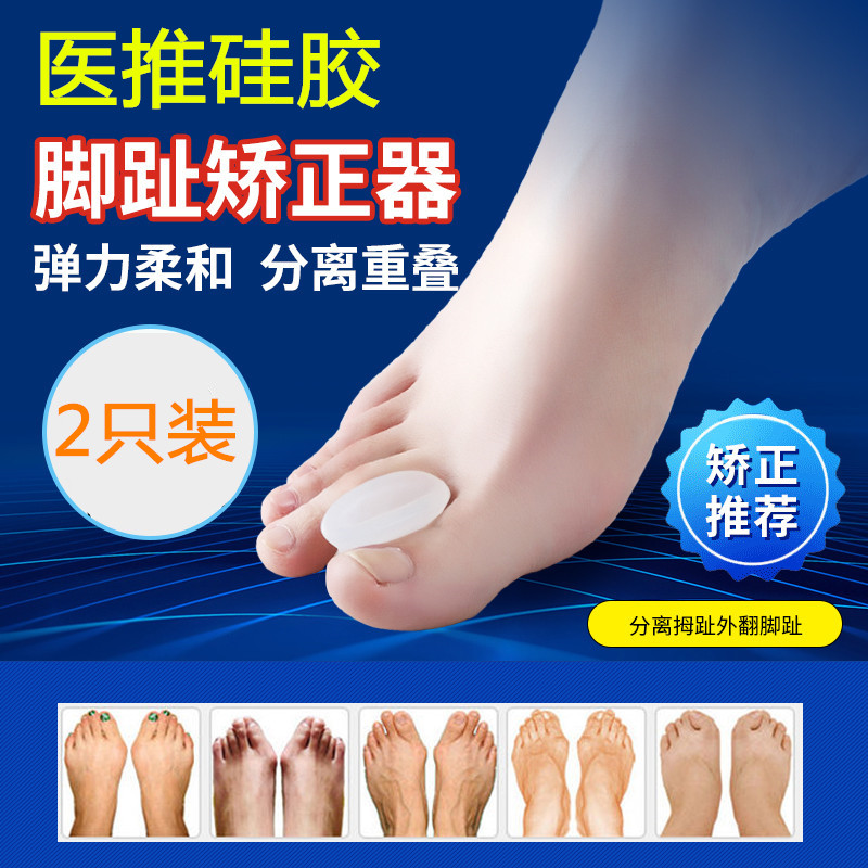 儿童拇指外翻小孩重叠脚趾矫正器