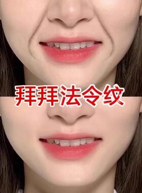 【2026爆卖】 适合急性子 告别法令纹 淡化嘴角纹~抗皱贴