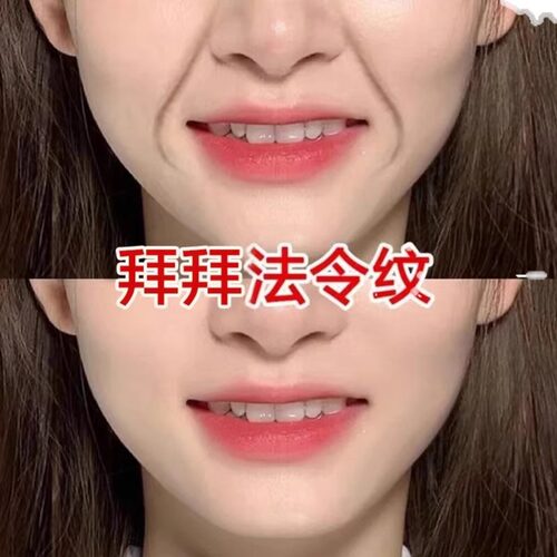 【2026爆卖】 适合急性子 告别法令纹 淡化嘴角纹~抗皱贴