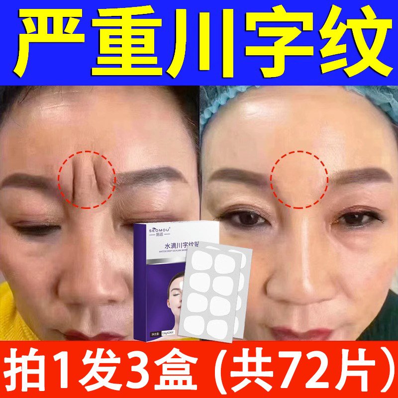 【买1发3盒】眉间川字纹贴