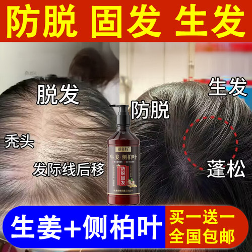 生姜+侧柏叶洗发水【防脱固发】