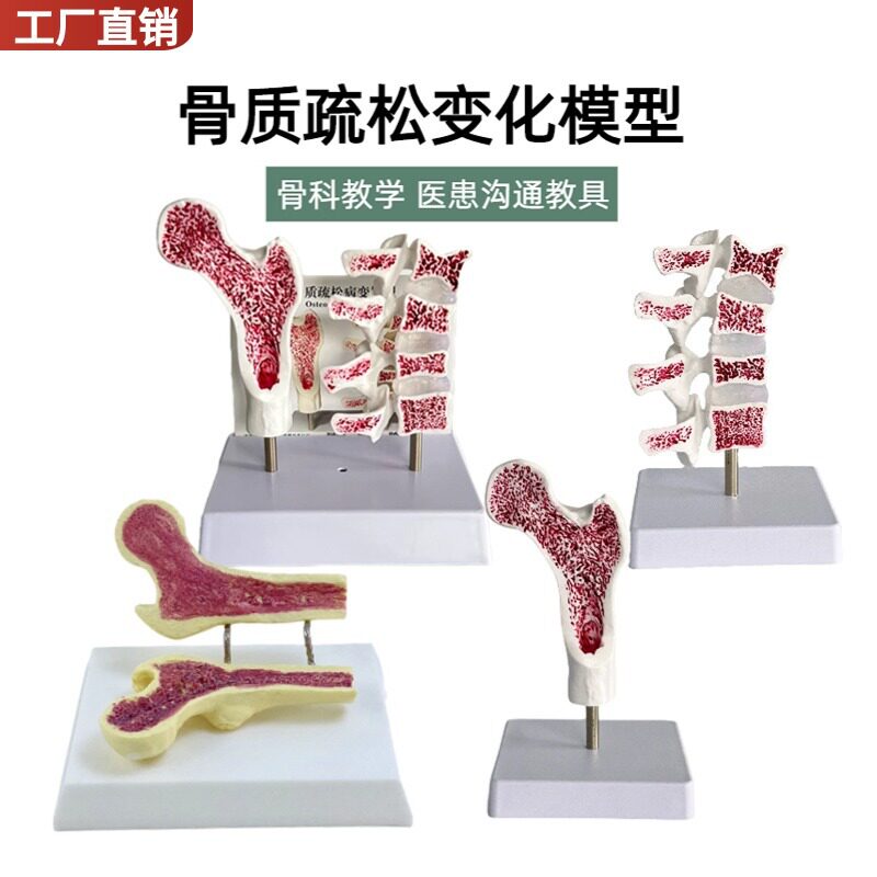 人体股骨骨质疏松解剖模型腿骨解教学仪器/实验器材