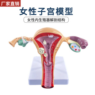 女病理子宫模型 妇产生殖卵巢子宫结构解剖 高级仿真病态子宫模型