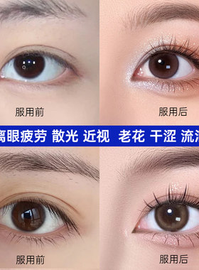 缓解成人营养素老年疲劳蓝莓脂咀嚼片近视力改善眼睛干涩模糊不清