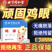 北京同仁堂御医匠鸡眼贴鸡眼膏鸡茧膏鸡贴眼膏去除老茧根脚底nn