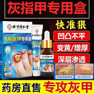 北京同仁堂御医匠灰指甲套盒指甲凹凸不平变黄增厚抑菌液正品yb5