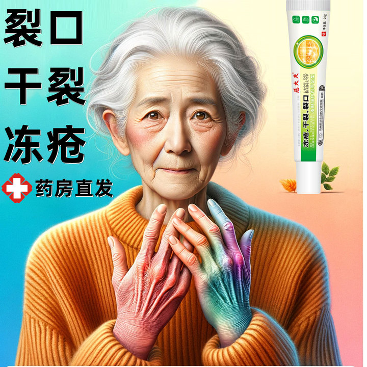 冻疮膏手足耳朵消肿止痒膏儿童秋冬手冻伤防冻防裂护手霜正品8nb