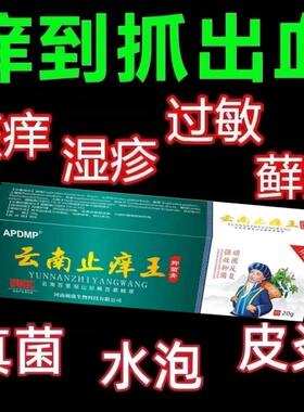 云南止痒王官方旗舰店止痒王正品抑菌乳膏皮肤外用直播同款1BV