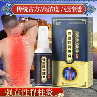 强直性脊柱炎强制性脊椎炎腰背痛晨僵致密性骨炎骶髂关节疼痛喷剂