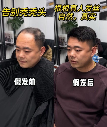 真人发头顶补发片透气内网全手织分缝自然遮盖白发假发女