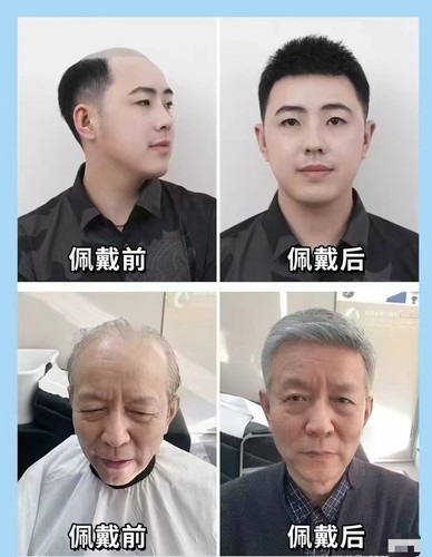 中老年真人发补发块全手织仿生头皮无痕遮白发头顶稀疏假发