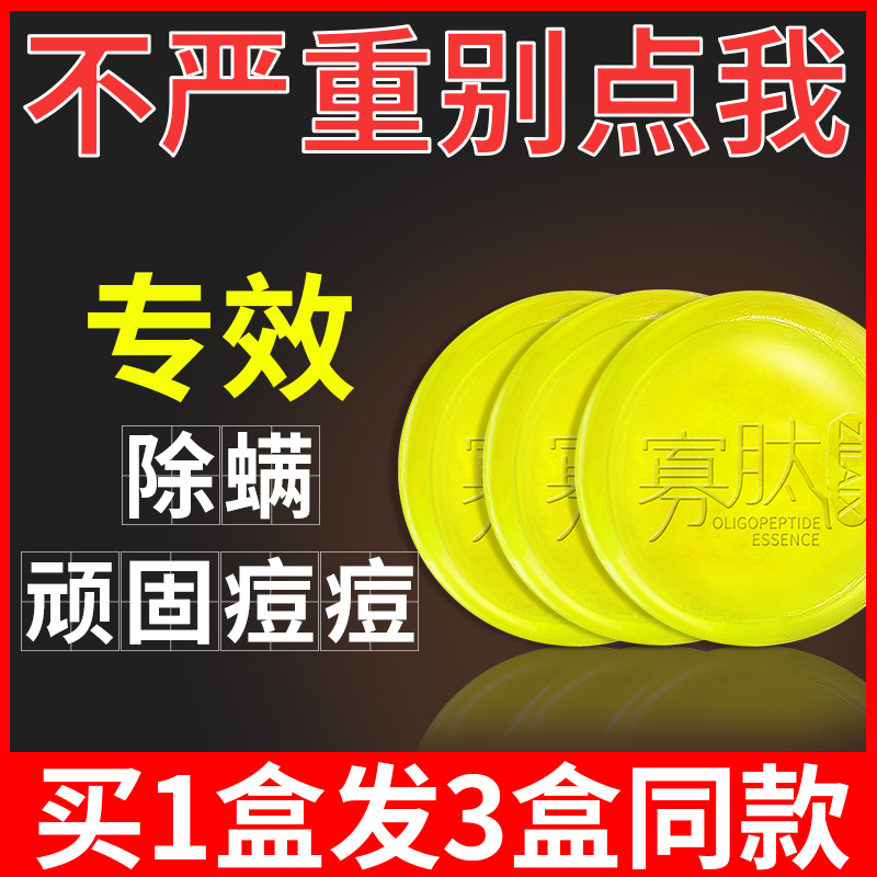 除螨虫香皂海盐祛痘杀菌全身面部背部深层清洁去螨虫脸部洗脸男女