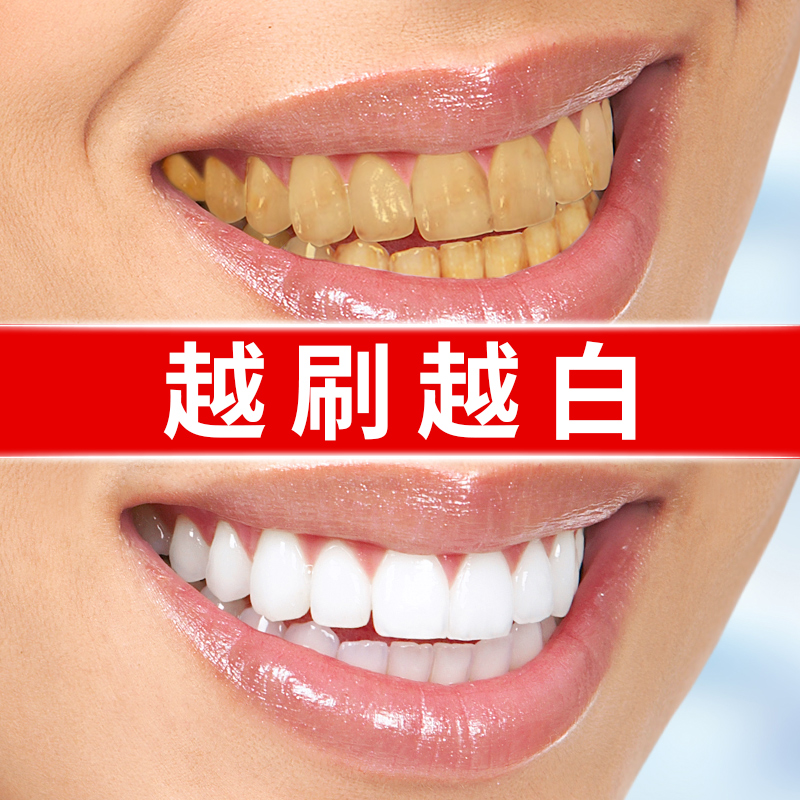 牙齿变美白神器洁白洗牙粉去黄牙洗白亮白牙贴速效牙烟渍牙渍去黄