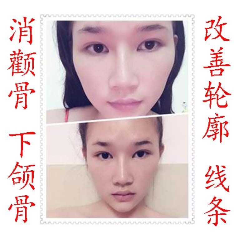 瘦脸磨骨瘦颧骨下颌骨精华缩小国字脸提拉双下巴紧致咬肌V脸男女