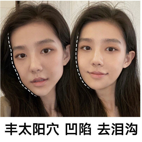 丰脸丰下巴精油V脸型翘下巴植物下巴变尖变长变翘改善短下巴后缩