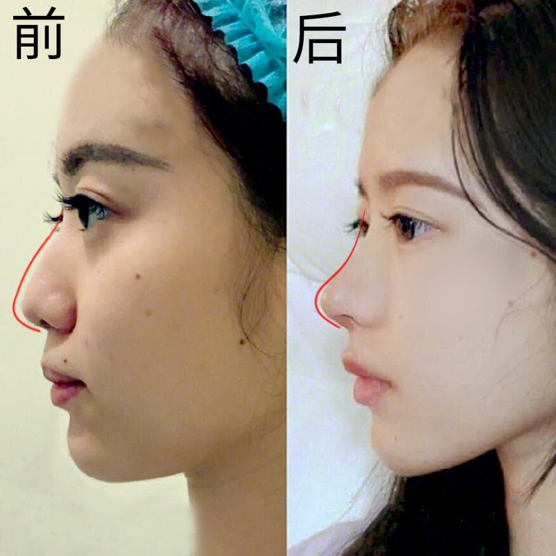 草本鼻梁挺直精华 挺翘直鼻立体美鼻精油加强版
