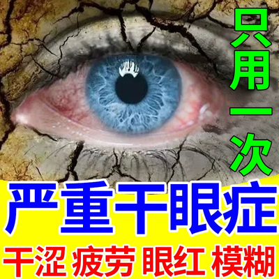 玻璃酸钠眼药水爱丽眼涩眼疲劳滴眼液干眼症热敷神器缓解疲劳干涩