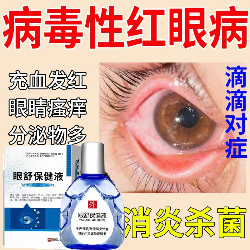 海王熊胆黄芩滴眼液急慢性结膜红眼病视疲劳电光性眼炎早期白内障