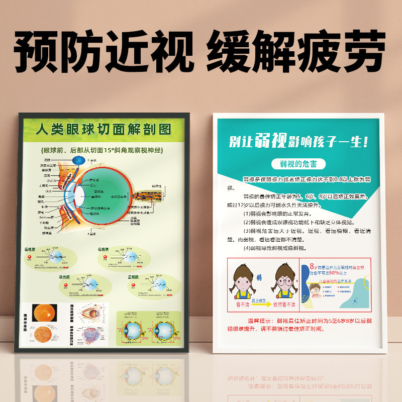 眼球解剖图剖面图眼睛眼球结构图爱眼护眼医院眼镜店展板宣传海报