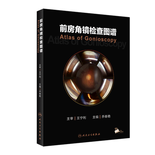 前房角镜检查图谱(精)