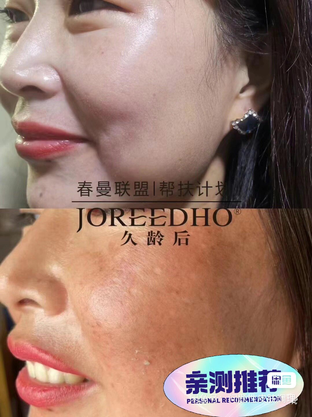 春曼久龄后修护冰膜 提亮肤色 淡黑色素祛黄 院线同款 打造苹果肌
