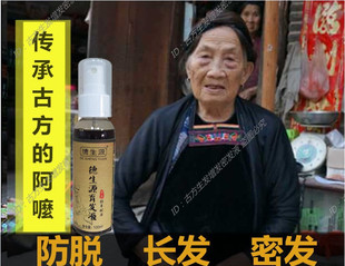 增发生发密发防脱生发液脂溢性秃顶掉发斑秃鬼剃头产后脱发生发水