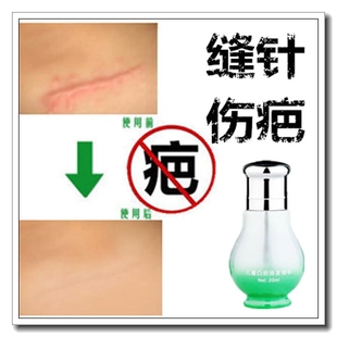 祛脸部擦伤摔伤愈合护理药膏淡化黑色素沉淀疤痕去除凹凸起硬疙瘩