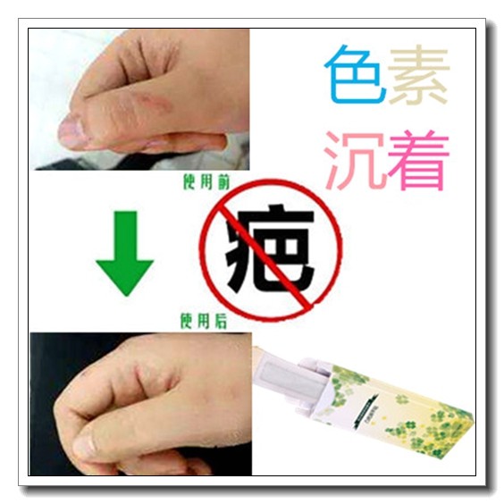 草本祛红印去除色素沉淀回流增生疤痕贴凸疤疙瘩淡化黑色素印产品,美容护肤/美体/精油,复方精油,淘宝优惠券,粉丝福利购,淘宝优惠卷