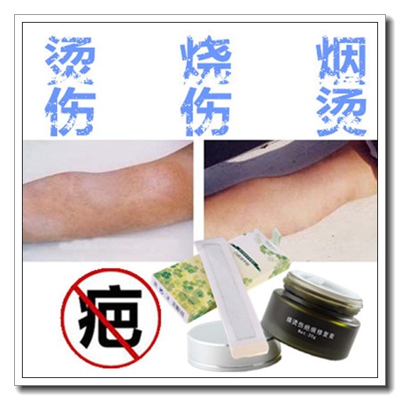 去除脸部巴痕膏祛手术烧烫伤疤痕灵产品淡化黑色素沉淀全身痘面霜,美容护肤/美体/精油,复方精油,淘宝优惠券,粉丝福利购,淘宝优惠卷