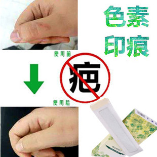 祛除黑色素印沉淀修复贴膏手术伤痕淡化男女色素沉着回流黑印药霜