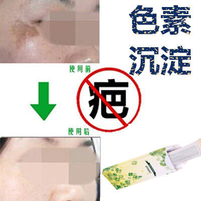 正品淡化抓伤暗红印痕痘疤痕贴去除黑印祛除黑色素印沉淀沉着产品,美容护肤/美体/精油,复方精油,淘宝优惠券,粉丝福利购,淘宝优惠卷
