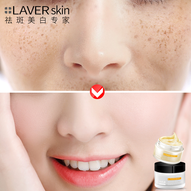 LAVERÀ³Þ±¶ûìî°ß˪ÃÀ°×ȥȸ°ßÒÅ´«°ß²úÆ·µ»¯É«°ßÄÐÅ®ÕýƷѧÉú
