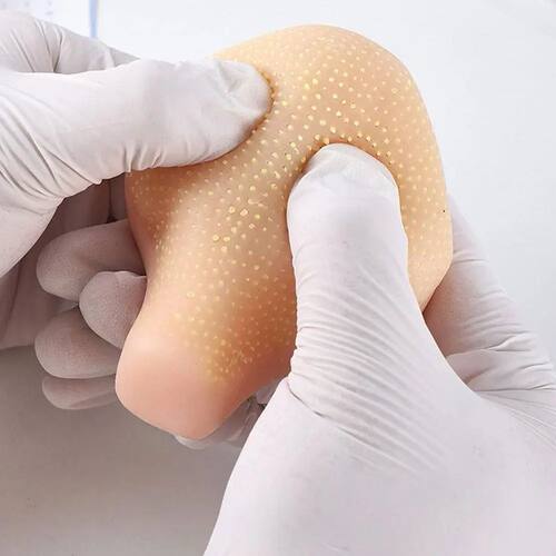 Realistic Pimple Popper Fidget Toy Silicone Sensory Sss Reli