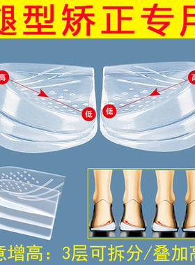 O型腿矫正鞋垫成人小腿外翻直腿神器外侧磨损纠正垫内八改善腿型