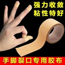 手足干裂贴高粘性贴布脚后跟开裂棉布贴耐磨皲裂透气愈合医用胶布